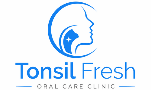 Tonsil Fresh